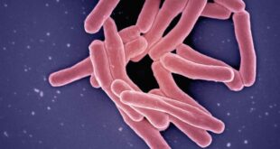 টিবি রোগ কি? টিবি রোগের লক্ষণ কি ( যক্ষ্মা )